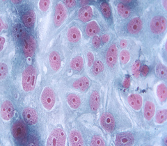 細(xì)胞侵襲、轉(zhuǎn)染